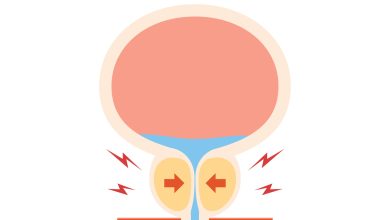 Conheça a cirurgia a laser altamente eficaz no tratamento da hiperplasia benigna da próstata