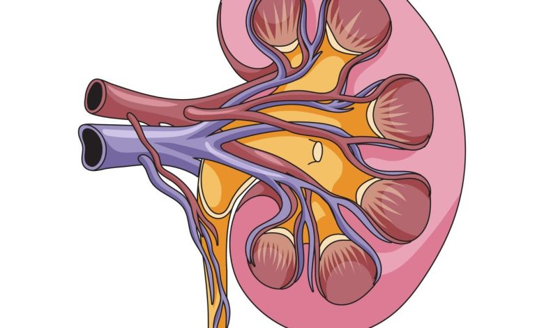 Nefrolitotripsia Percutânea o que é e quando é indicada