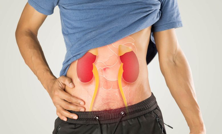 O que fazer para aliviar a dor da cólica renal